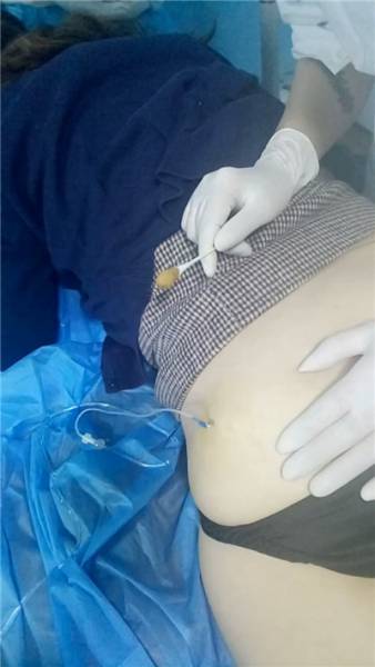 【稀有猎奇】 重口味恋痛熟女在无证黑美容院接受药物针扎屁股2